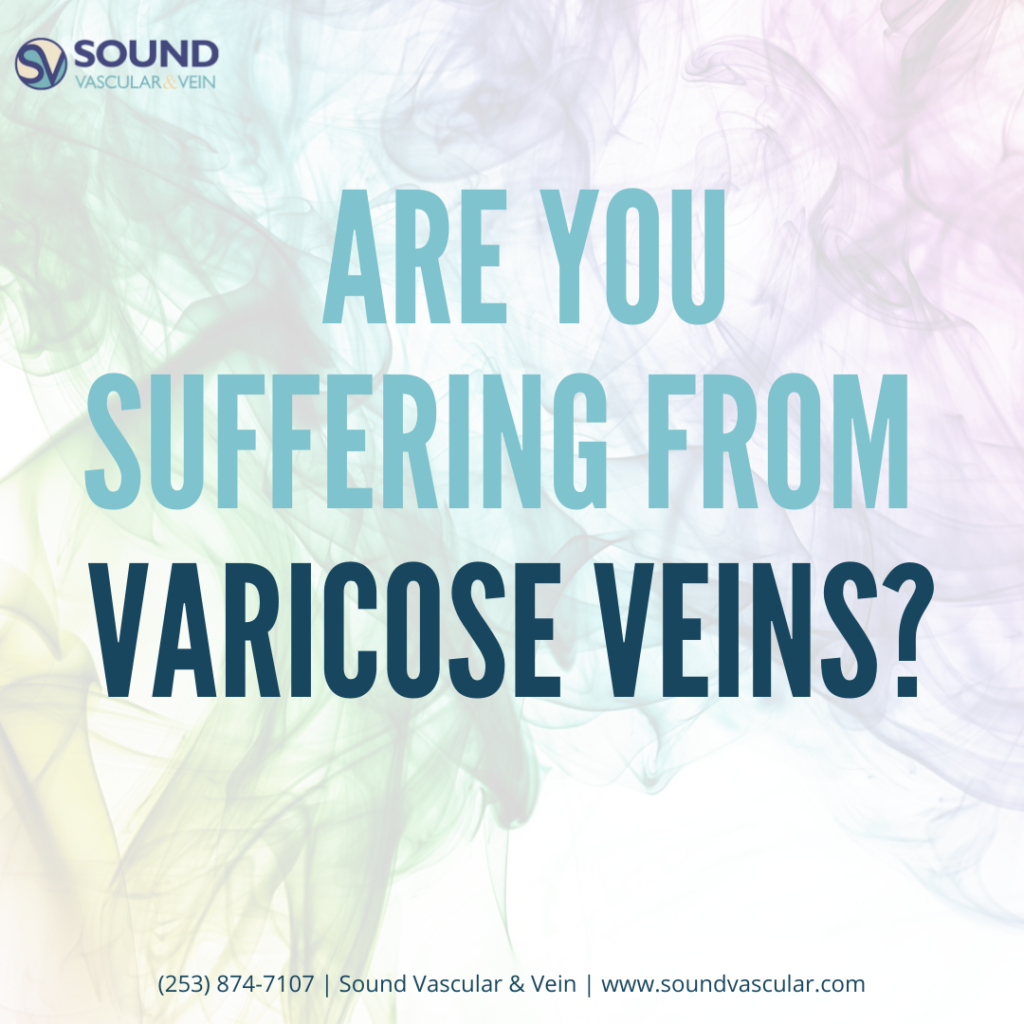 varicose vein doctor,excellent interventional radiologist near Seattle Washington