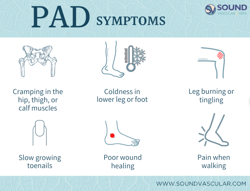 vascular interventional experts Washington,PAD treatment Washington